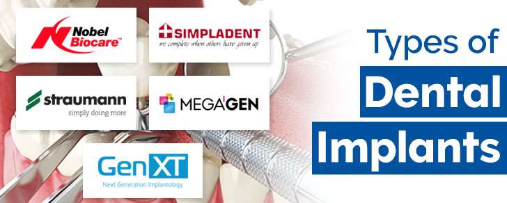 Types of Dental Implants